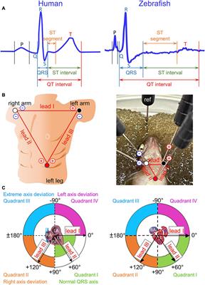 Constructing Adult Zebrafish Einthoven’s Triangle to Define Electrical Heart Axes